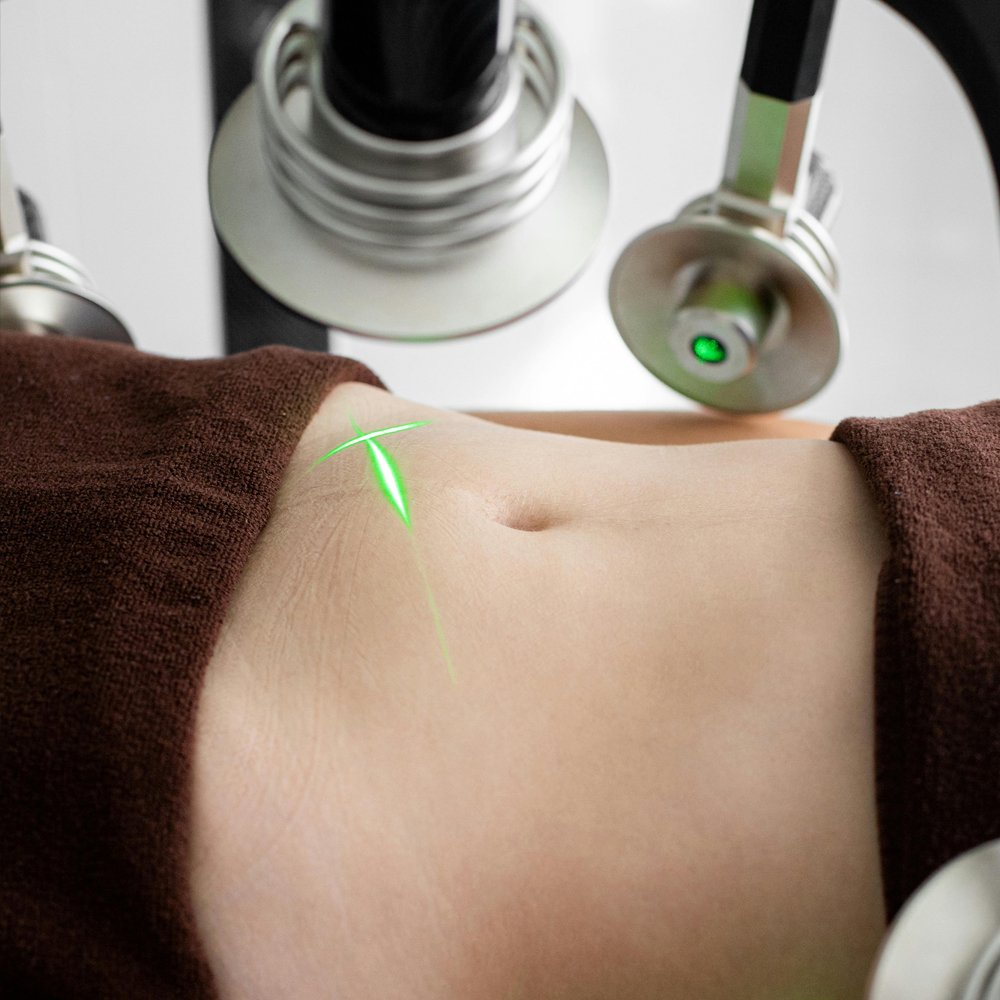 Laser Fat Reduction Works